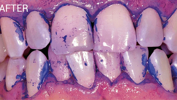 Dentisterie esthétique Paris 16