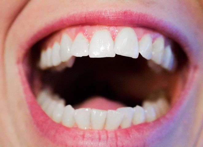 Dentiste gencive Paris 16