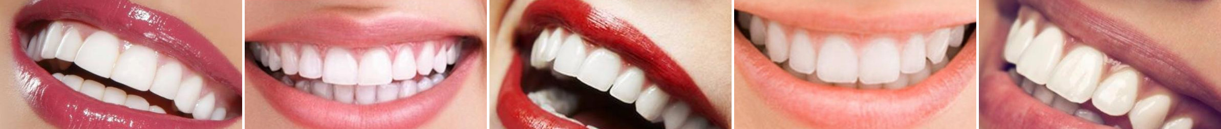 Dentiste Paris 16 Dr Sandy Cohen Bruxisme : Questions / Réponses